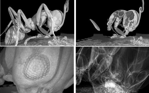 CT scan of ant